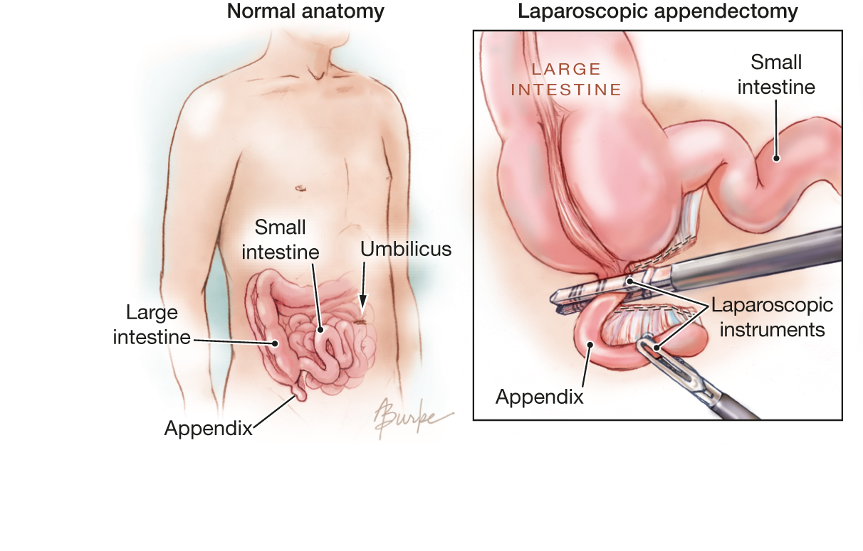 Anesthesiology