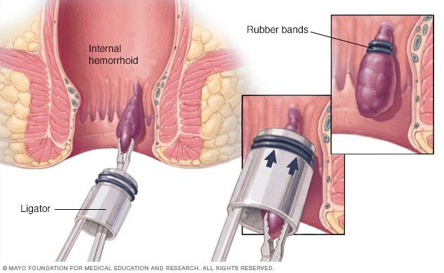 Anesthesiology