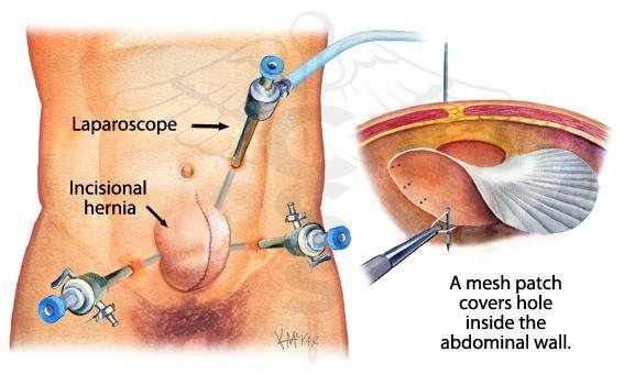 Anesthesiology